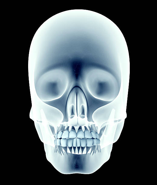 istock x-ray image of a skull with teeth 493788626