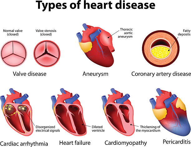 heart disease heart disease heart ventricle stock illustrations