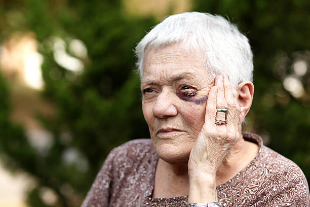 mujer de edad avanzada con ojo negro - cardenal lesión física fotografías e imágenes de stock