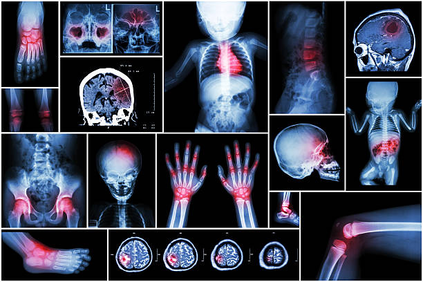 x -ray 複数の部品のお子様のボディ&複数の疾患 - human spine mri scan x ray doctor ストックフォトと画像