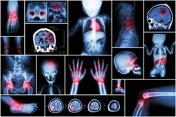 X-ray multiple part of child 's body & multiple disease
