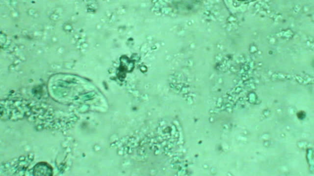 Microorganisms - paramecium