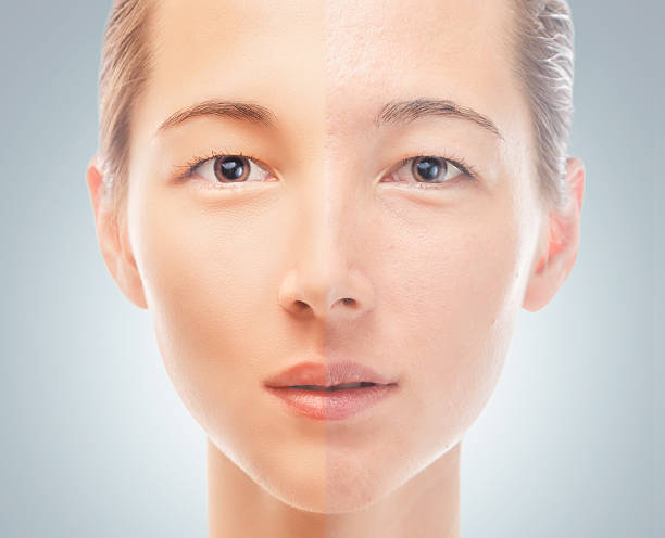 Skin of woman before and after the cosmetics procedure stock photo