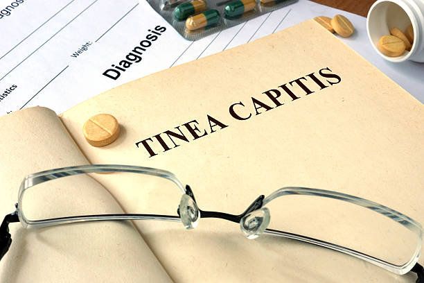 istock Word Tinea capitis on a paper and pills 494571928
