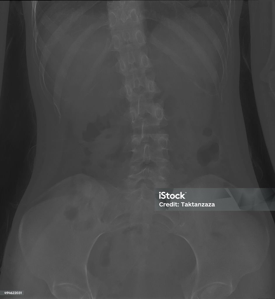 bone x-ray-film - Lizenzfrei Anatomie Stock-Foto