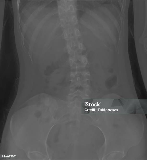 Foto de Osso Raiox De Filme e mais fotos de stock de Anatomia - Anatomia, Artrite, Ciência