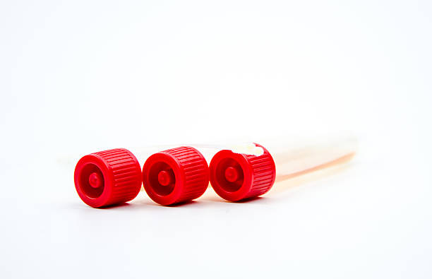 istock Pharyngeal swab and tube 494762785