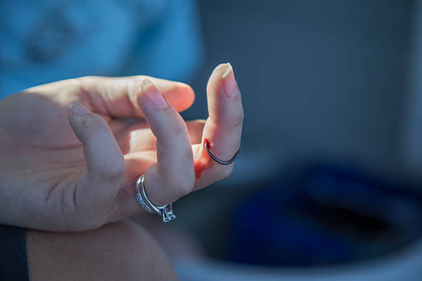 istock Lady with a hook stuck in her finger 494787209
