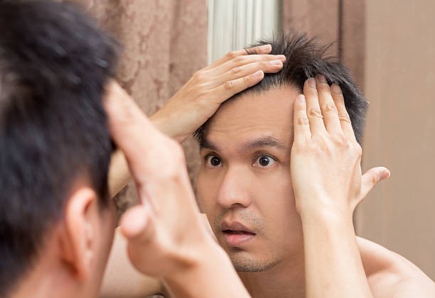 istock Mirror reflection of asian handsome man viewing his scalp 494787641