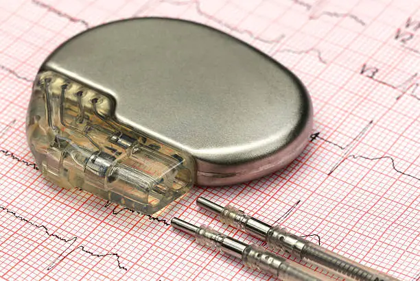 Photo of Electrocardiograph with pacemaker