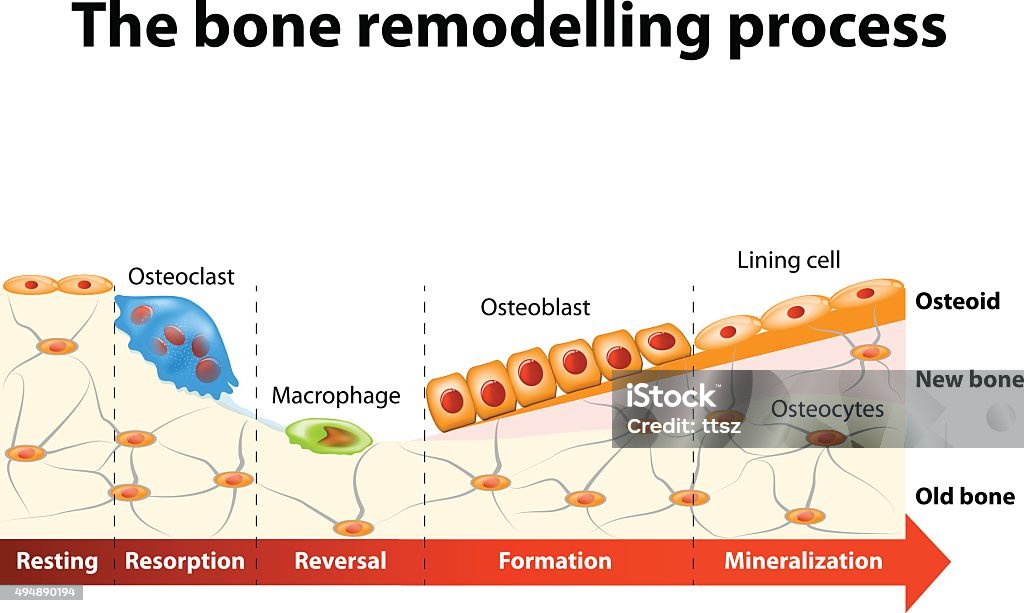Bone Remodelling Process Stock Illustration - Download Image Now ...