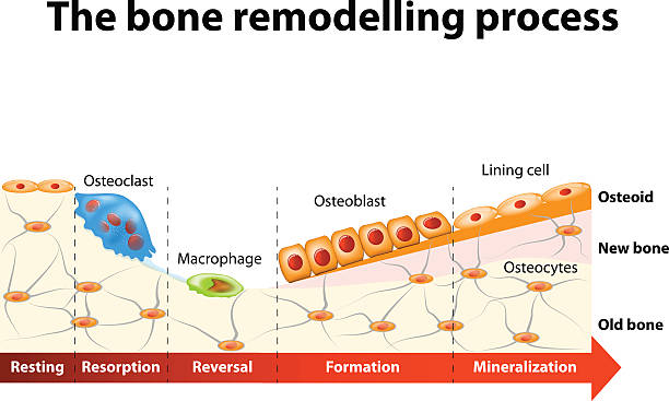 Bone Remodelling Process Stock Illustration - Download Image Now -  Osteoclast, Osteoblast, Osteoporosis - iStock