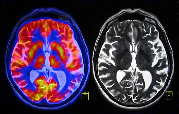 badanie mri mózgu - mri scan obrazy zdjęcia i obrazy z banku zdjęć