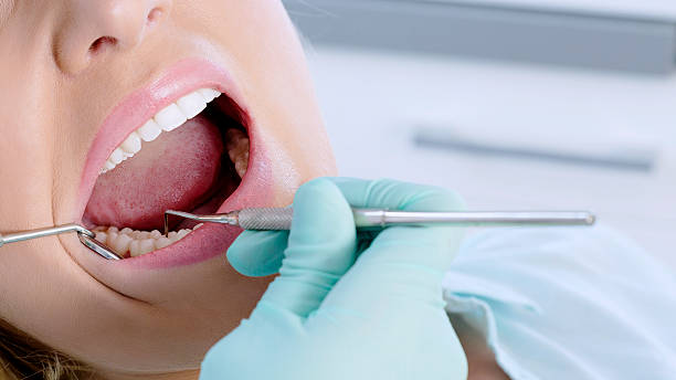istock Young woman at the dentist 494939248