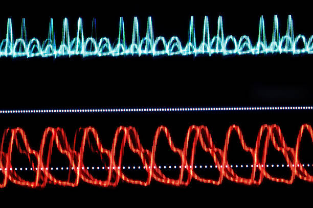 istock ECG graph on the monitor pixelated 494944314