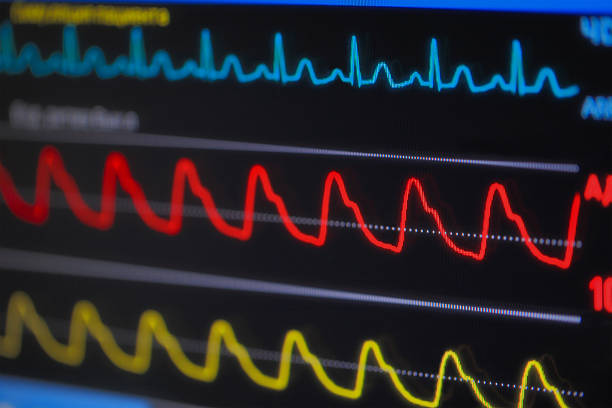 istock Waves ECG on monitor in perspective 494944428