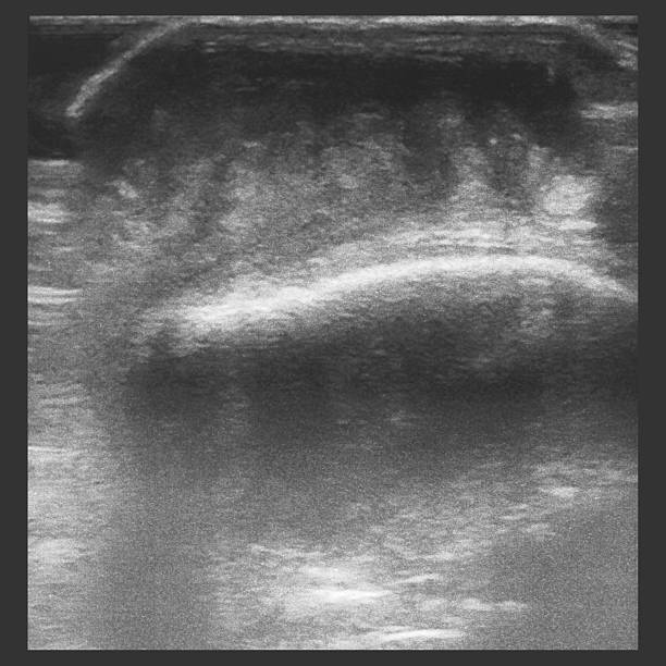 istock Osteoarticular ultrasonography 495035696