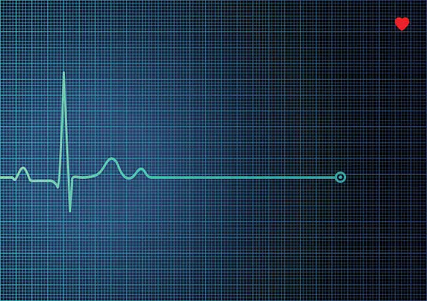 Vector illustration of Electrocardiogram EKG