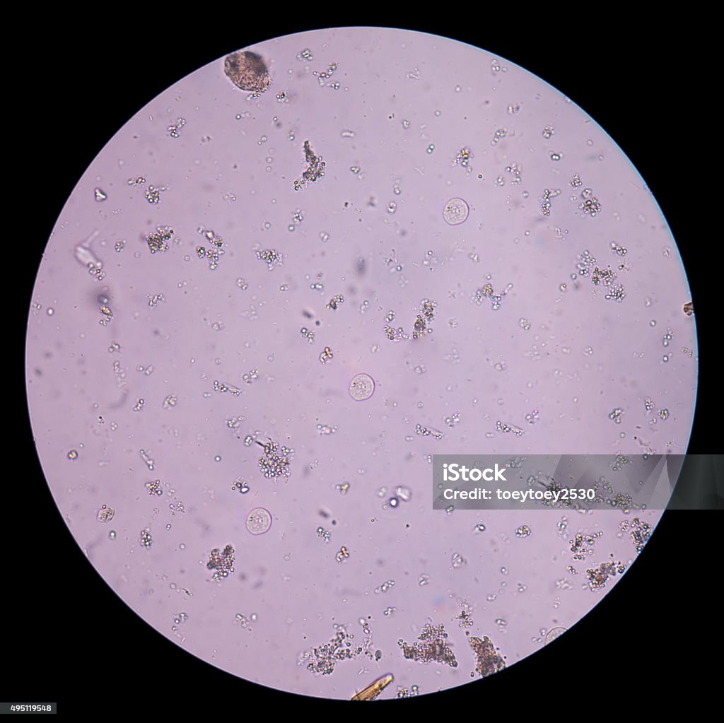 Examen protozoa en las heces. - Foto de stock de 2015 libre de derechos