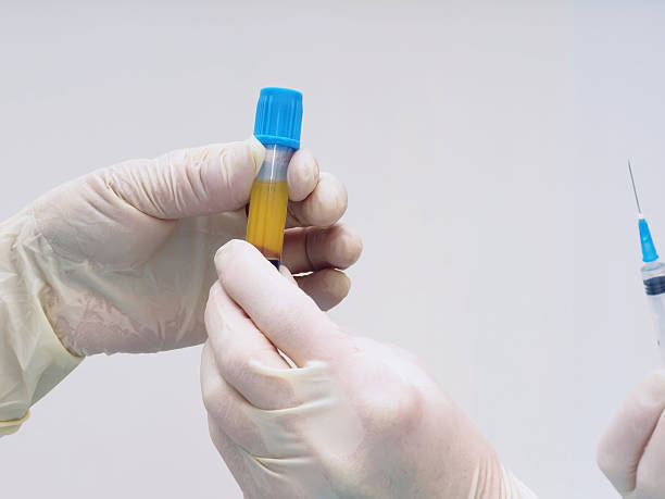 istock Hands holding separated blood and plasma in test tube laboratory 495230914