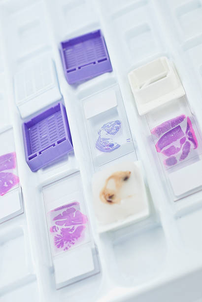 istock histology stuff in slide tray 495353279