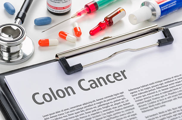 The diagnosis Colon Cancer written on a clipboard