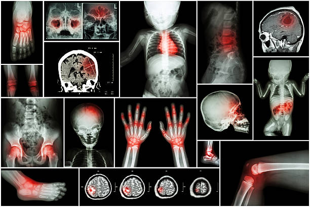 x -ray 複数の部品のお子様のボディ&複数の疾患 - human spine mri scan x ray doctor ストックフォトと画像