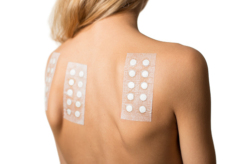 A blond woman with dermatology patch test on her back to determinate kind of skin sensability and alergy reaction.