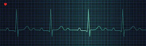 Vector illustration of Cardiogram