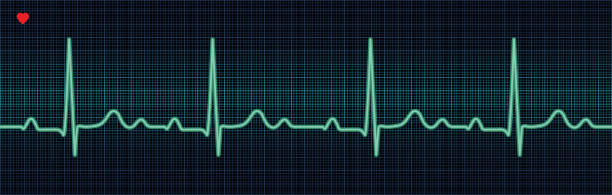 ilustraciones, imágenes clip art, dibujos animados e iconos de stock de traza el ecg - pulse trace taking pulse computer monitor healthcare and medicine