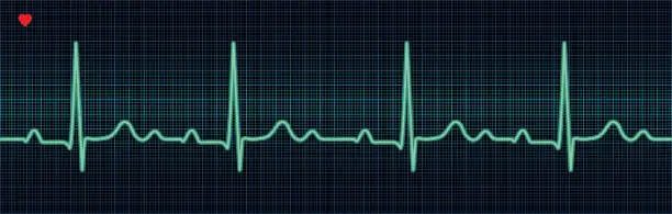 Vector illustration of EKG Trace