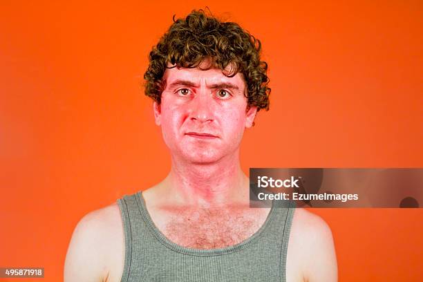 Sunburned Sweaty Man Stock Photo - Download Image Now - Sunburned, Men, Embarrassment