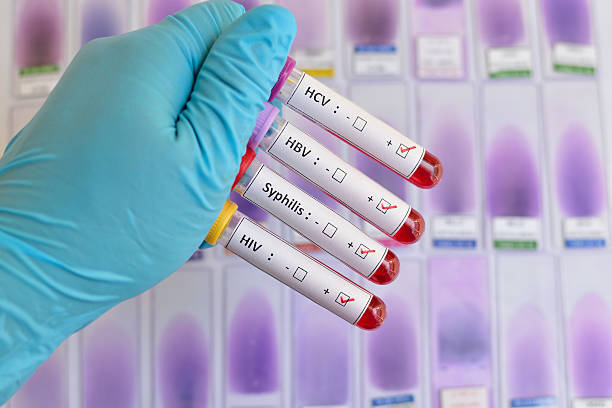 malattie a trasmissione sessuale: l'hiv, hbv, hcv, syphilis - aids test foto e immagini stock