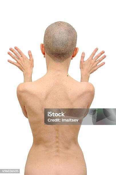 Bald Woman Back Stock Photo - Download Image Now - Rear View, Shaved Head, One Woman Only