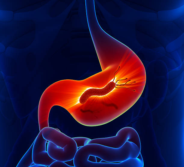 helicobacter pylori de estómago - pylori fotografías e imágenes de stock