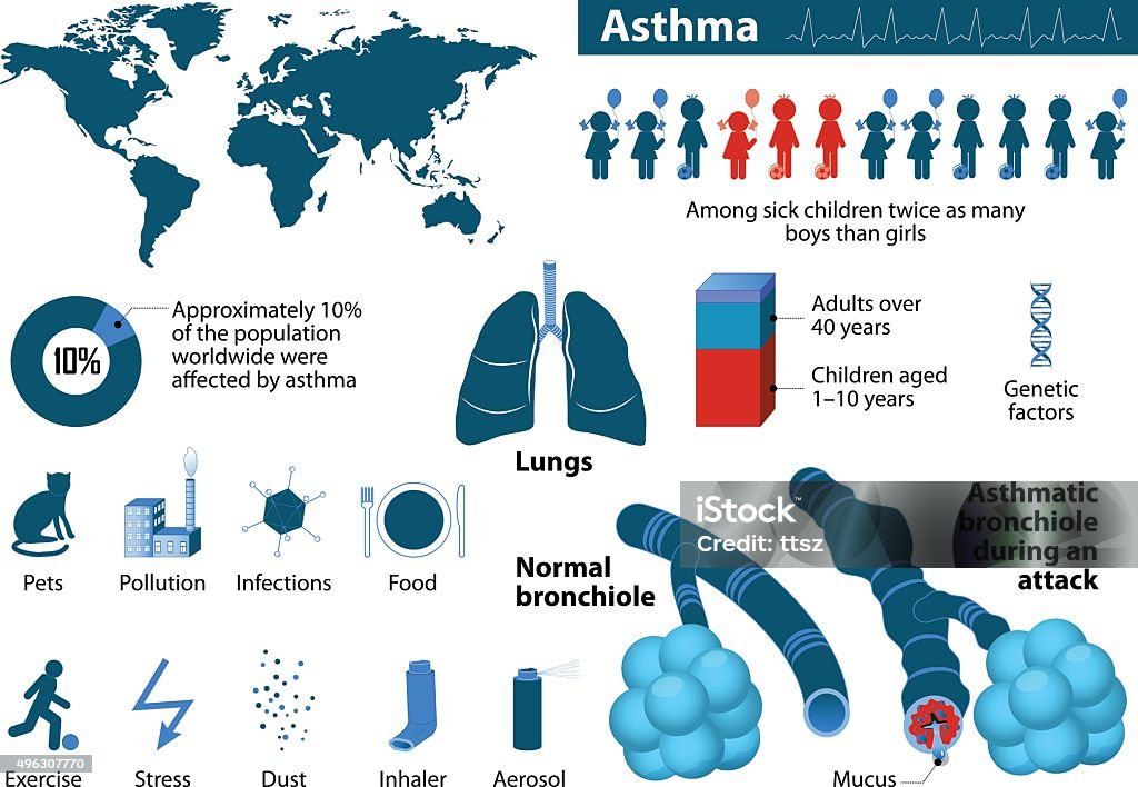 Infográfico de asma - Vetor de Asmático royalty-free