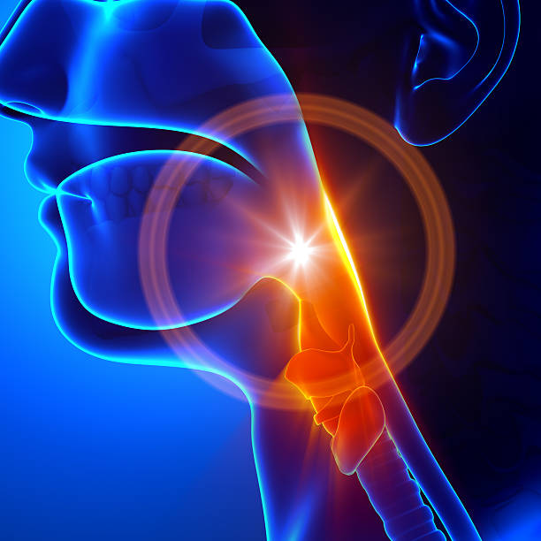 Sore throat - Flu / Cold / Stuck throat Sore throat - Flu / Cold / Stuck throat larynx stock pictures, royalty-free photos & images