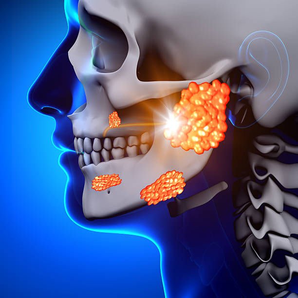 caxumba/parotid glândula-enjoo - nasal cavity - fotografias e filmes do acervo