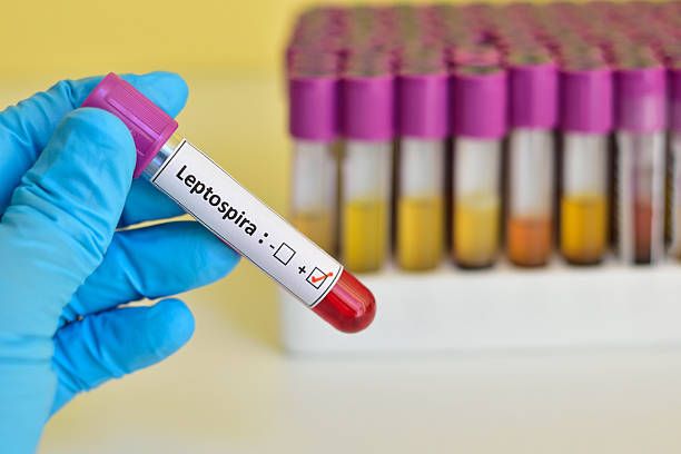 Leptospira positive Blood sample positive with Leptospira bacteria leptospira stock pictures, royalty-free photos & images