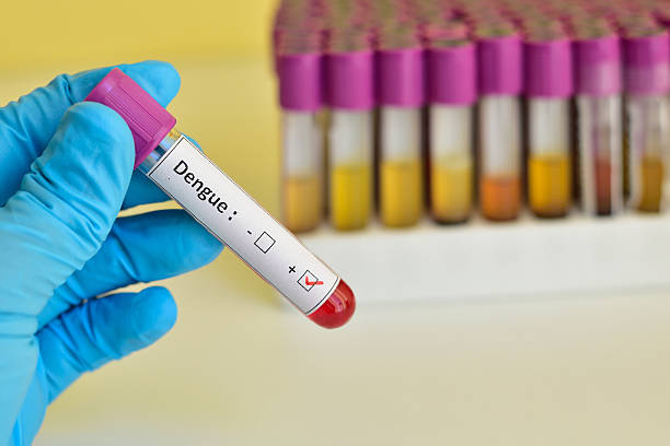 Dengue blood sample stock photo