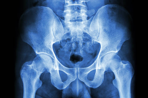 human's pelvis and hip joints film x-ray human's pelvis and hip joints coccyx photos stock pictures, royalty-free photos & images