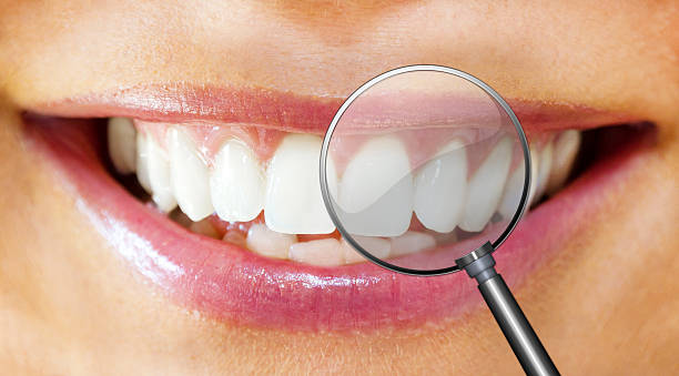 istock Teeth of a woman with magnifier 496636840