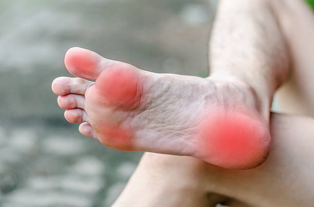 istock Male foot pain, Man's problem concept 496701246