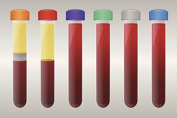 ilustrações de stock, clip art, desenhos animados e ícones de os tubos de amostras de sangue - blood sample blood tubing test tube