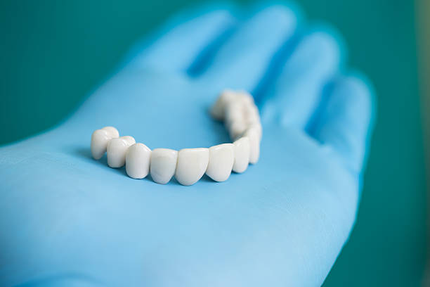 ponte de dentista - machine teeth imagens e fotografias de stock