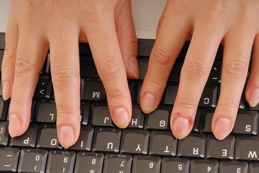 Bloody Fingers typing on a computer keyboard