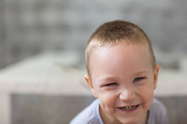 Little boy with swollen eye Little boy with a swollen eye laughs despite the problem human eye scratching allergy rubbing stock pictures, royalty-free photos & images