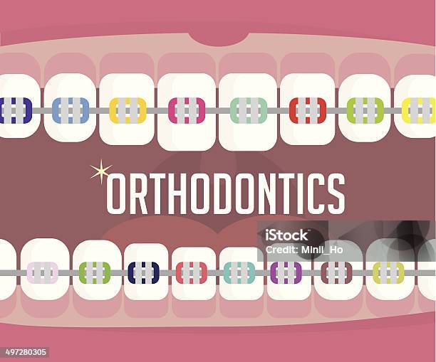Ortodoncja Aparat Ortodontyczny - Stockowe grafiki wektorowe i więcej obrazów Aparat ortodontyczny - Aparat ortodontyczny, Ortodonta, Uśmiechać się