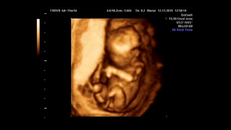 17,000+ Ultrasound Stock Videos and Royalty-Free Footage - iStock