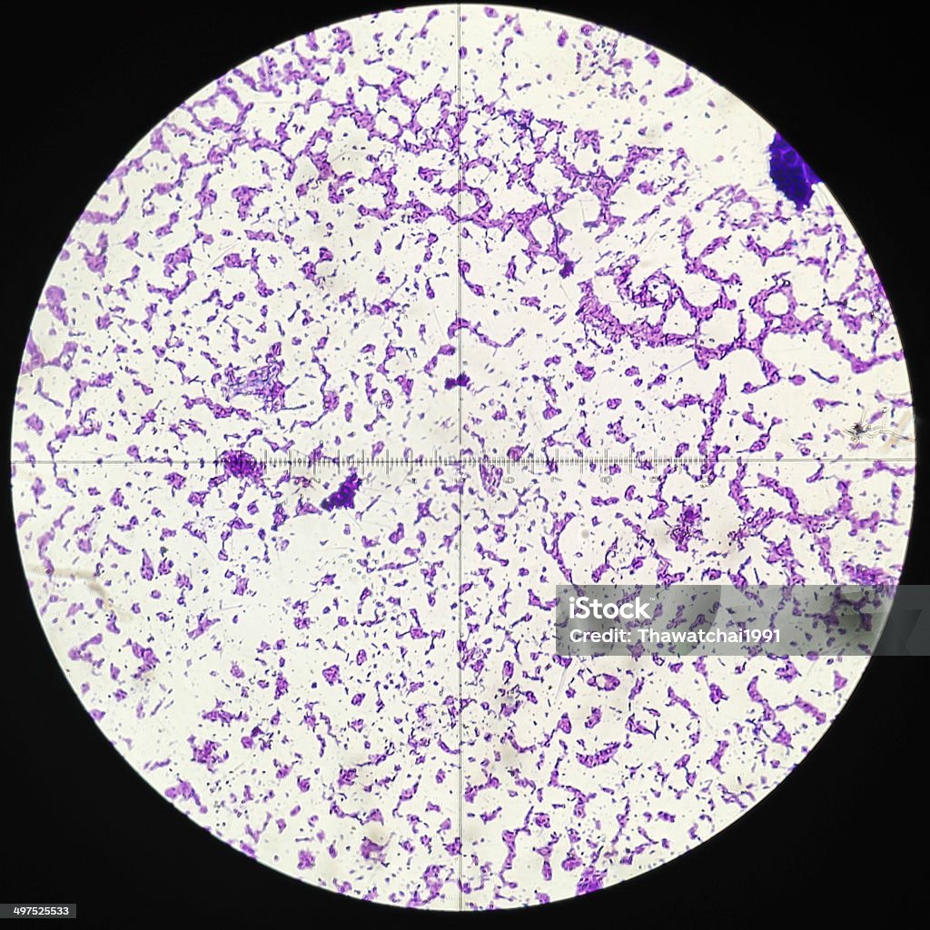 Fotomicrografía de Penicillium - Foto de stock de Abstracto libre de derechos